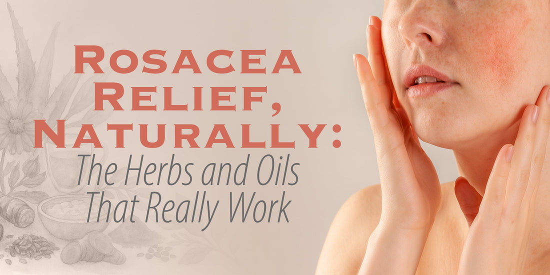 Rosacea Relief, Naturally: The Herbs and Oils That Really Work
